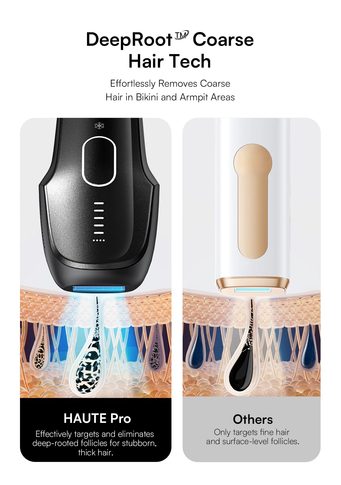 INIA Laser Hair Removal with Ice-Cooling Care for Women and Men, Painless at-Home IPL Hair Remover for Coarse Hair in Bikini and All Body Areas, Latest Generation for Effective Results (Black)