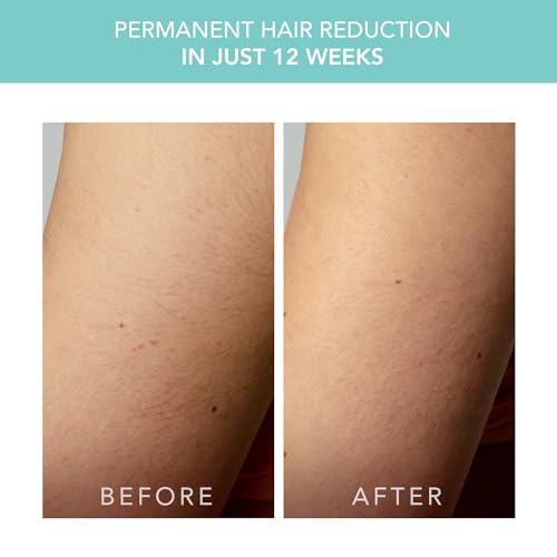 FOREO Peach 2 go IPL Hair Removal Device - Travel-Friendly Permanent Hair Removal - Laser Hair Removal - Body & Face - Painless Hair Removal - Skin Cooling & Silicone Shield - Customizable Artic Blue