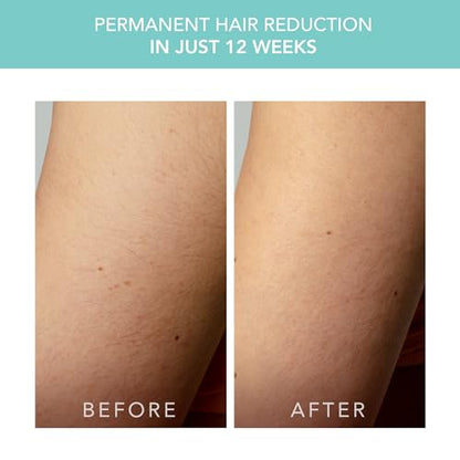 FOREO Peach 2 go IPL Hair Removal Device - Travel-Friendly Permanent Hair Removal - Laser Hair Removal - Body & Face - Painless Hair Removal - Skin Cooling & Silicone Shield - Customizable Artic Blue