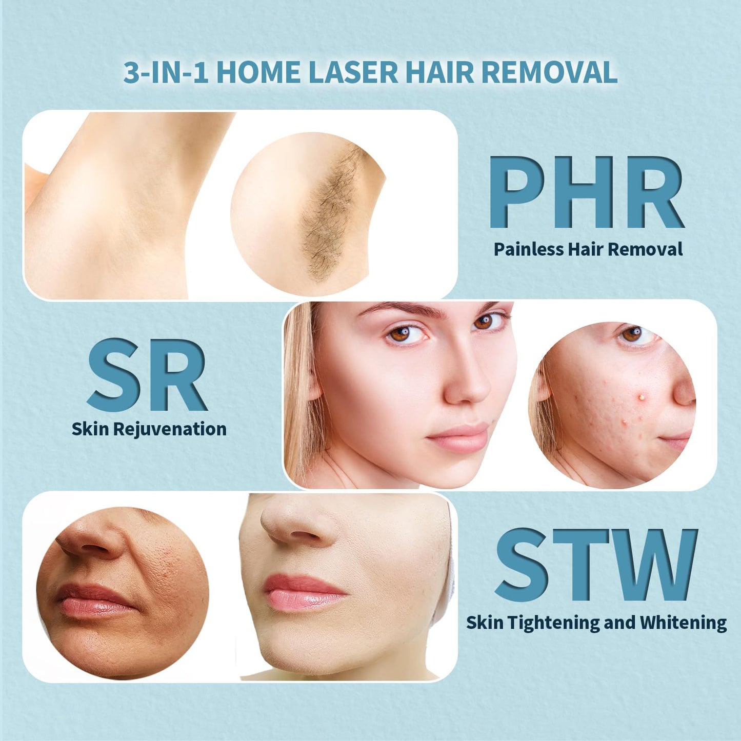 REEOOH Laser Hair Removal for Women & Men, At Home IPL Cooling Hair Removal Device, 3 in 1 Painless Facial Armpits Arms Legs Bikini Line Hair Removal, Ideal Gift for Girl Women Men